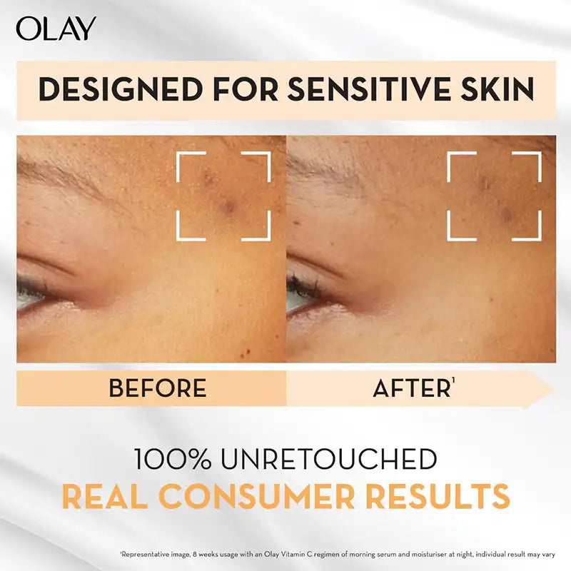 Olay Luminous Vitamin C Sensitive Moisturiser 50g