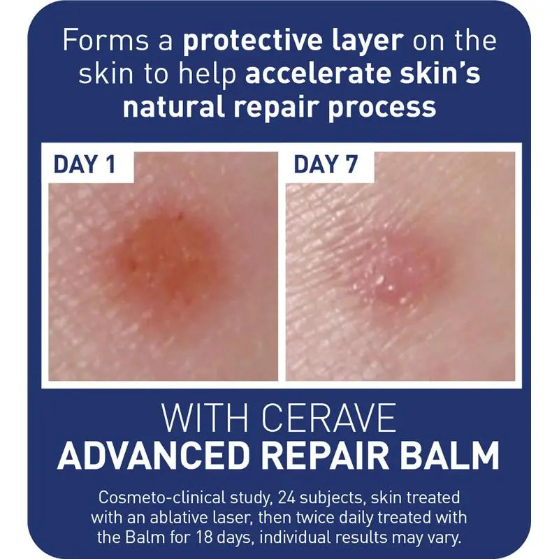 CeraVe Advanced Repair Balm 88ml