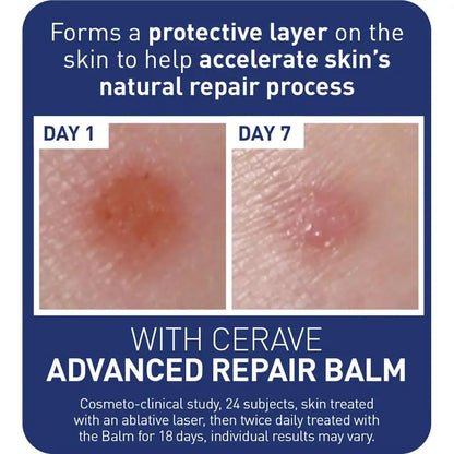 CeraVe Advanced Repair Balm 88ml