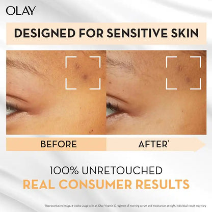 Olay Luminous Vitamin C Sensitive Moisturiser 50g