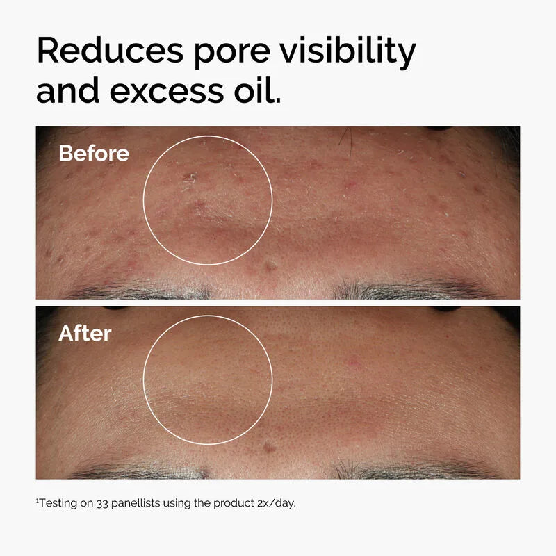 The Ordinary Niacinamide 10% + Zinc 1% Serum 60ml