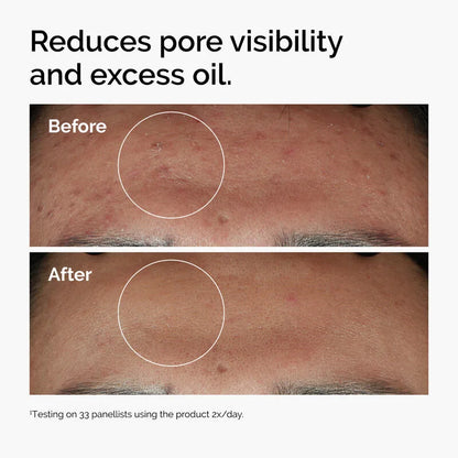 The Ordinary Niacinamide 10% + Zinc 1% Serum 30ml